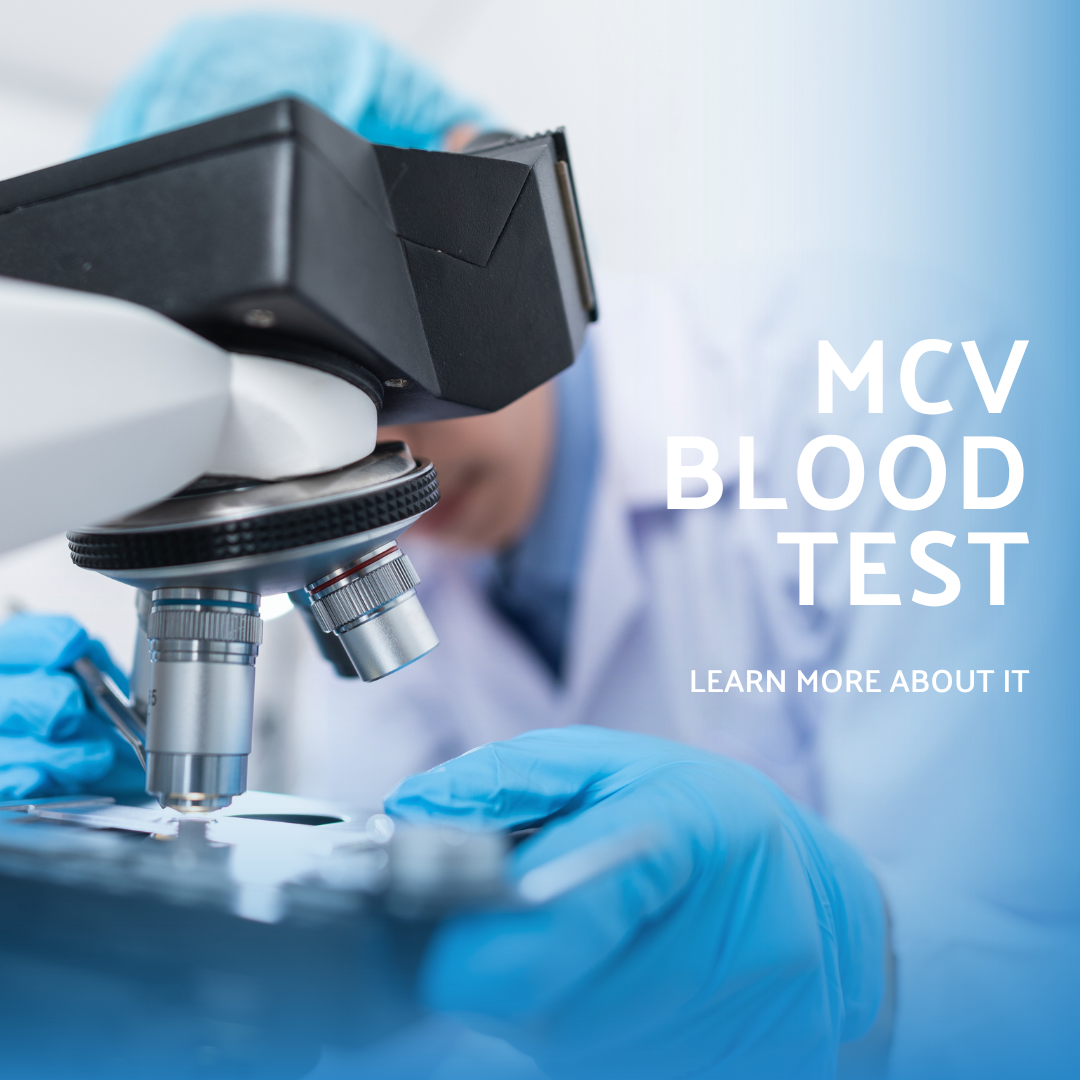 MCV Blood Test