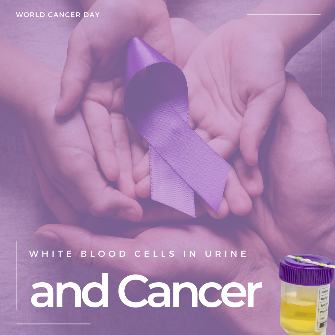 White Blood Cells in Urine and the Link to Cancer