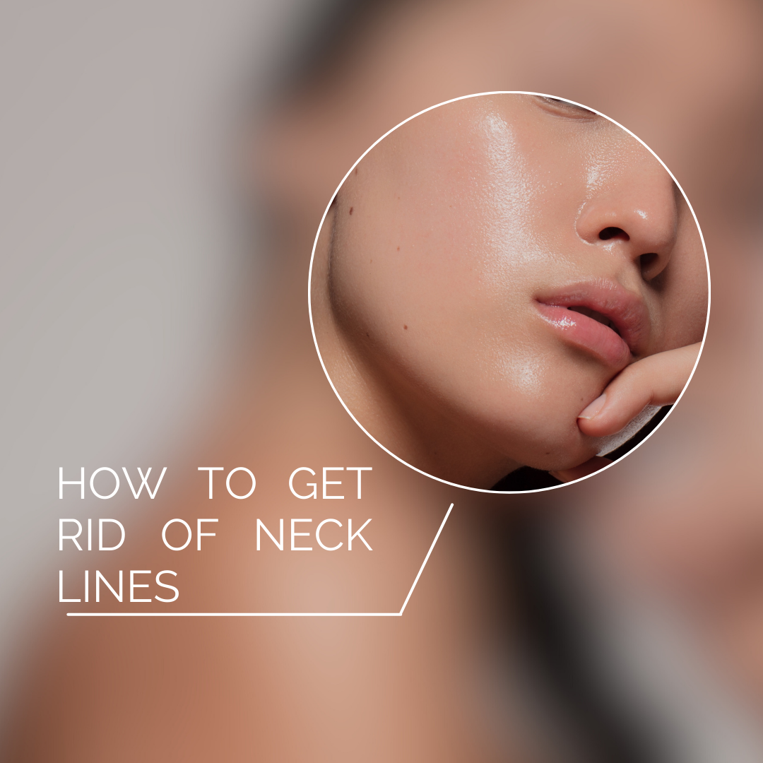 How to Get Rid of Neck Lines