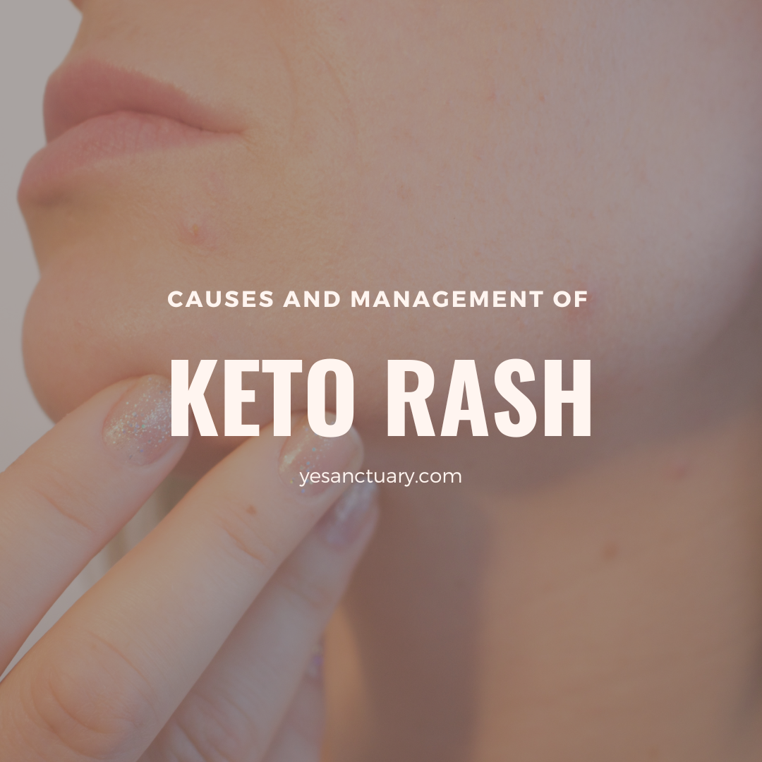 Keto Rash: Causes, Prevention, and Management