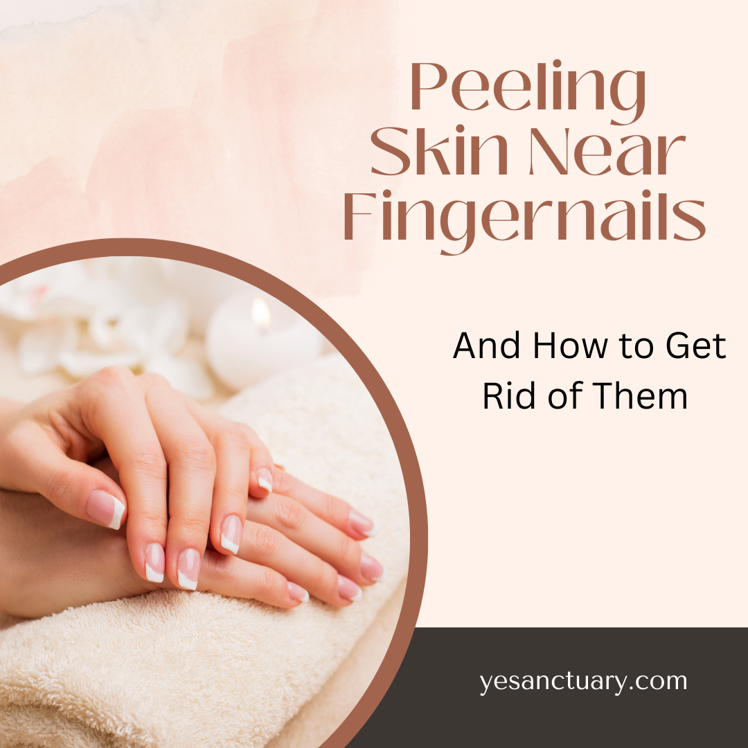 Peeling Skin Near Fingernails