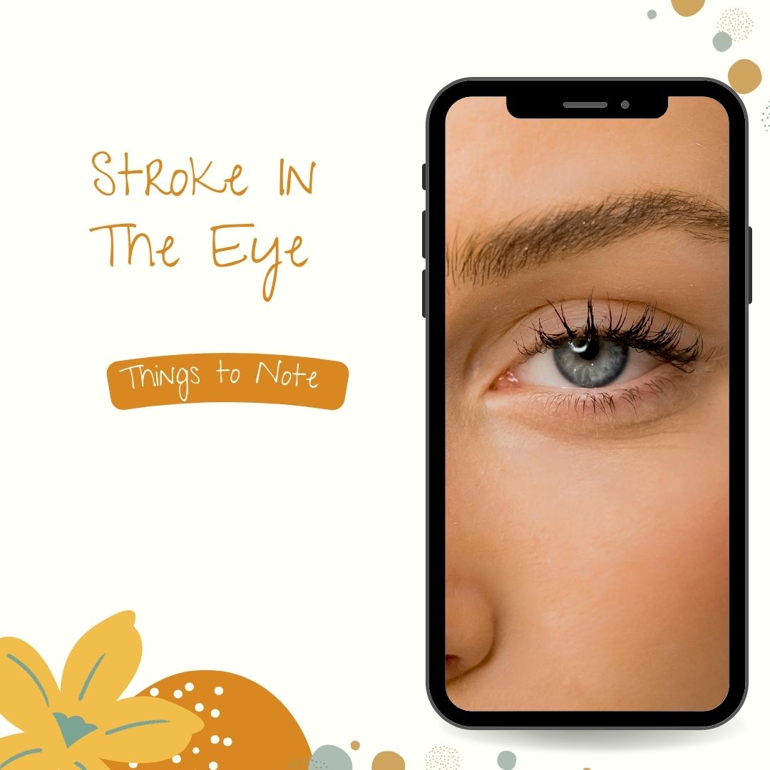Stroke in the Eye
