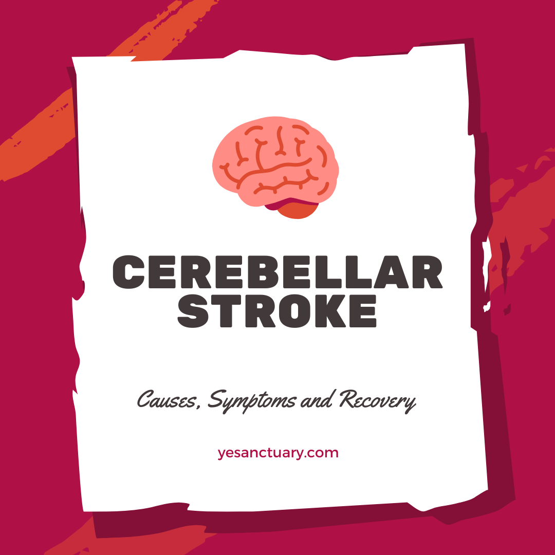Cerebellar Stroke