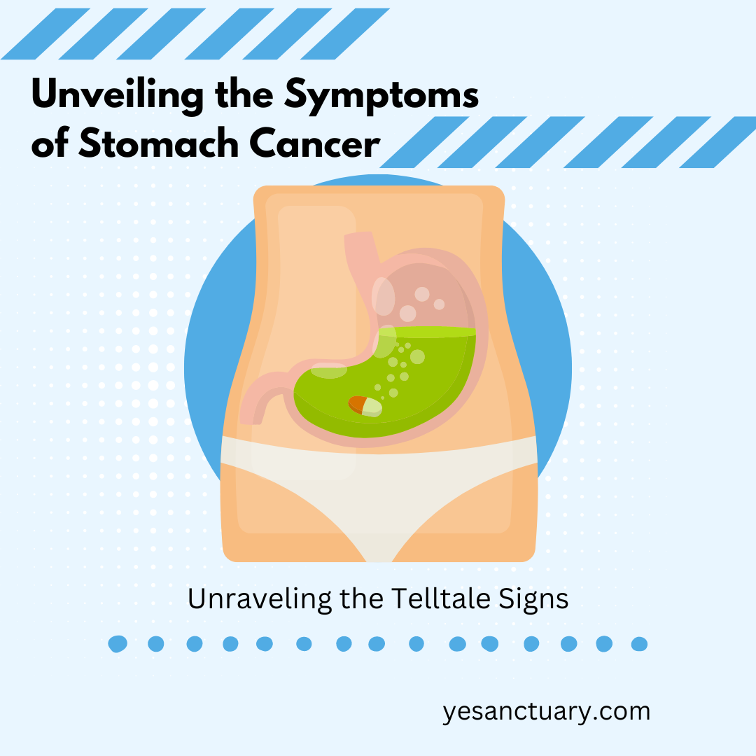 Symptoms of Stomach Cancer
