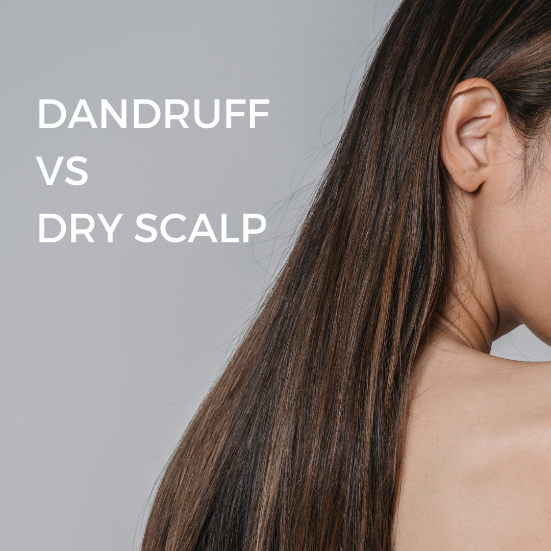 Dandruff vs. Dry Scalp