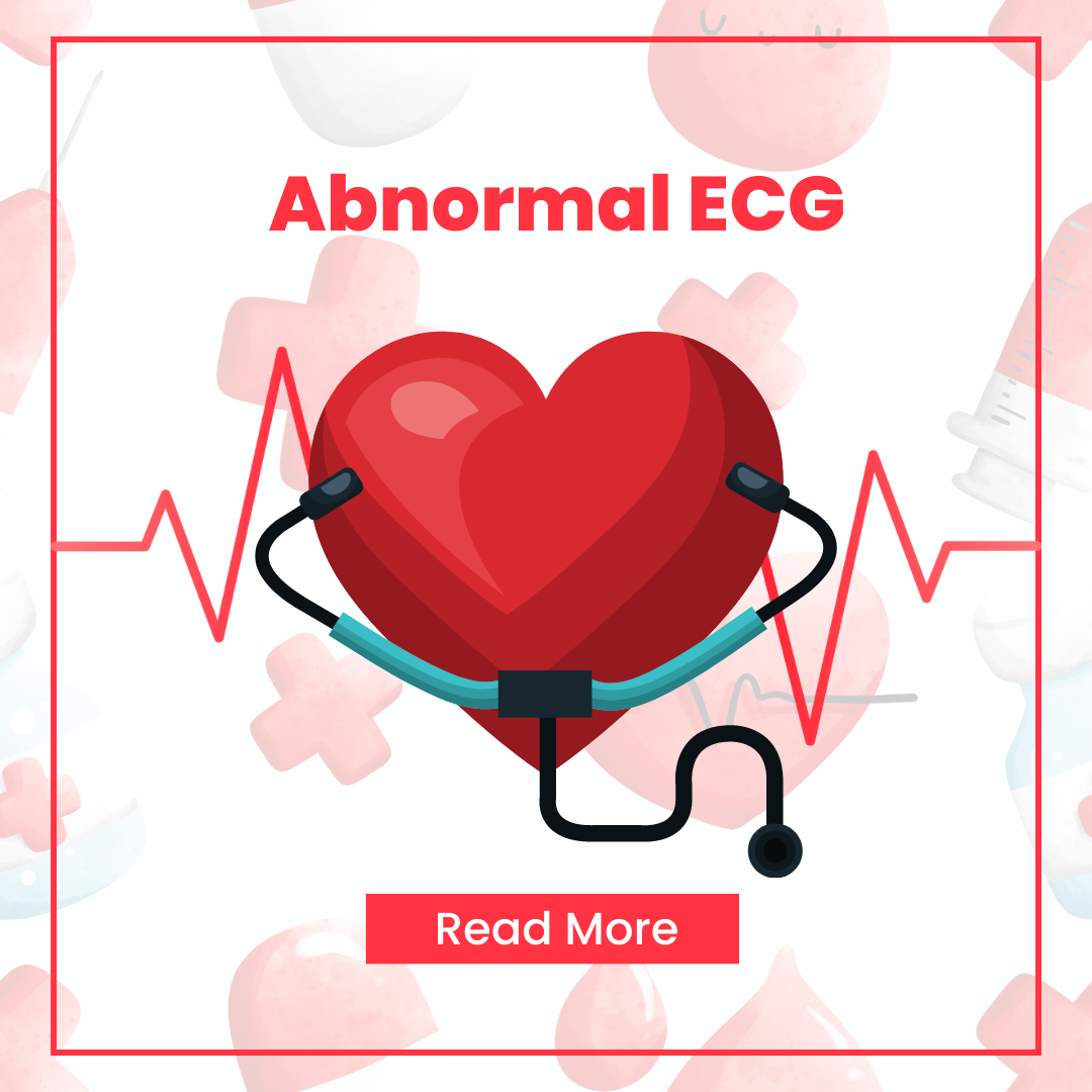 Abnormal ECG Results