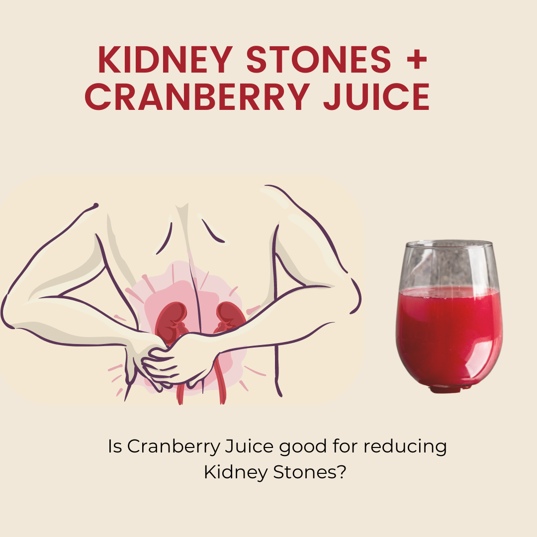 The Powerful Benefits of Cranberries in Preventing Kidney Stones