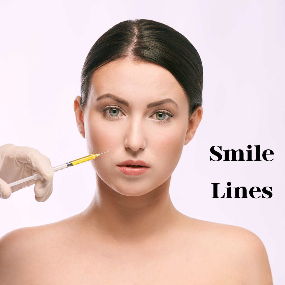 Smile Lines: A Journey to Natural Beauty