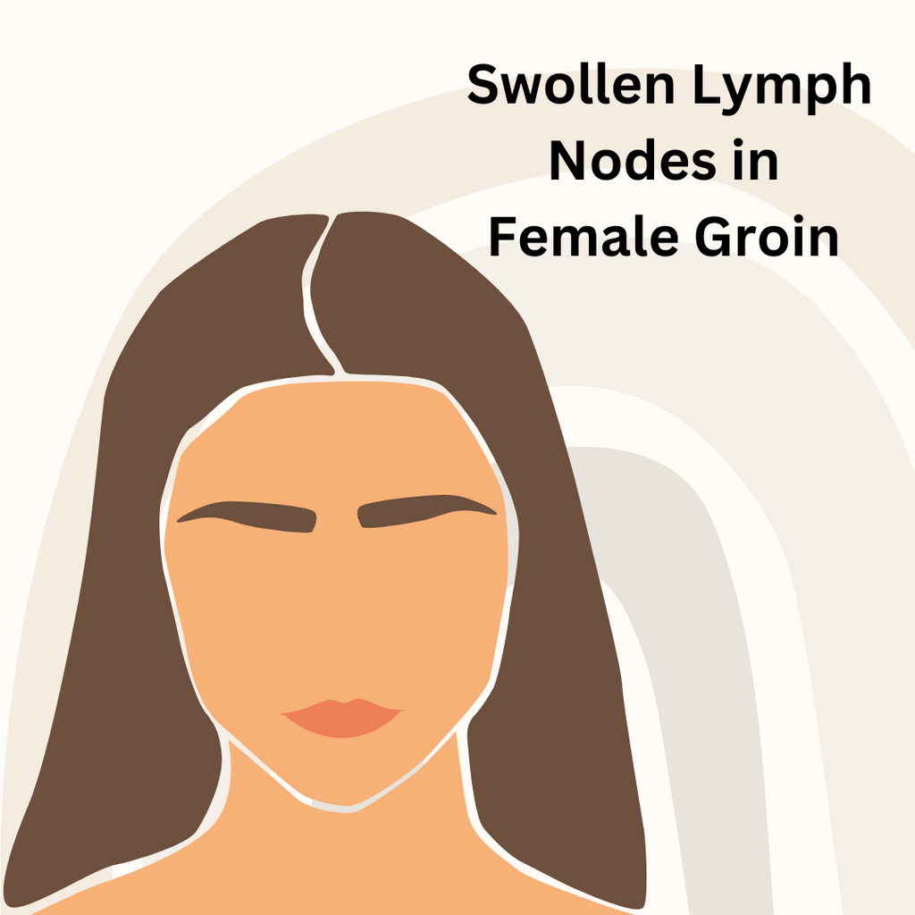 Swollen Lymph Nodes in the Groin in Females