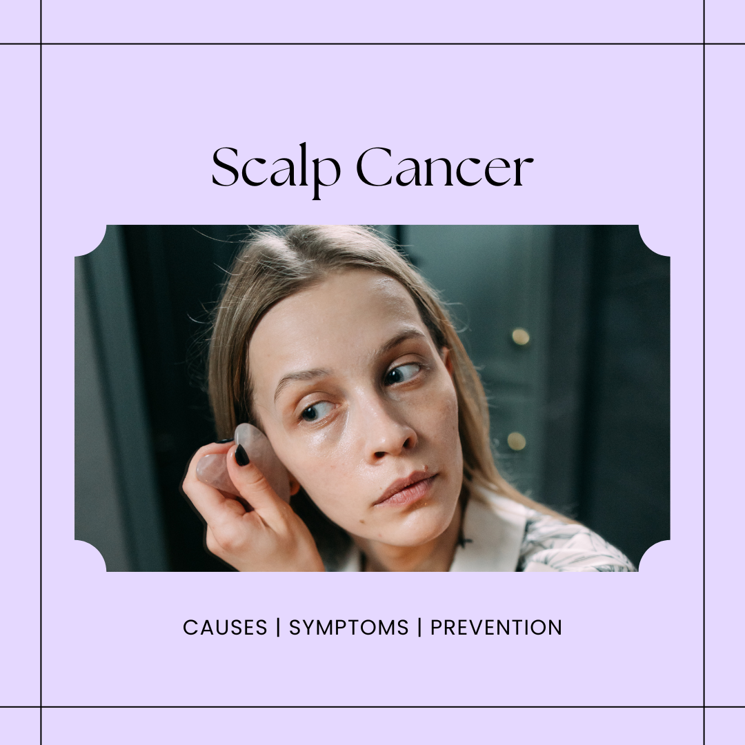 Scalp Cancer: Causes, Symptoms, and Prevention