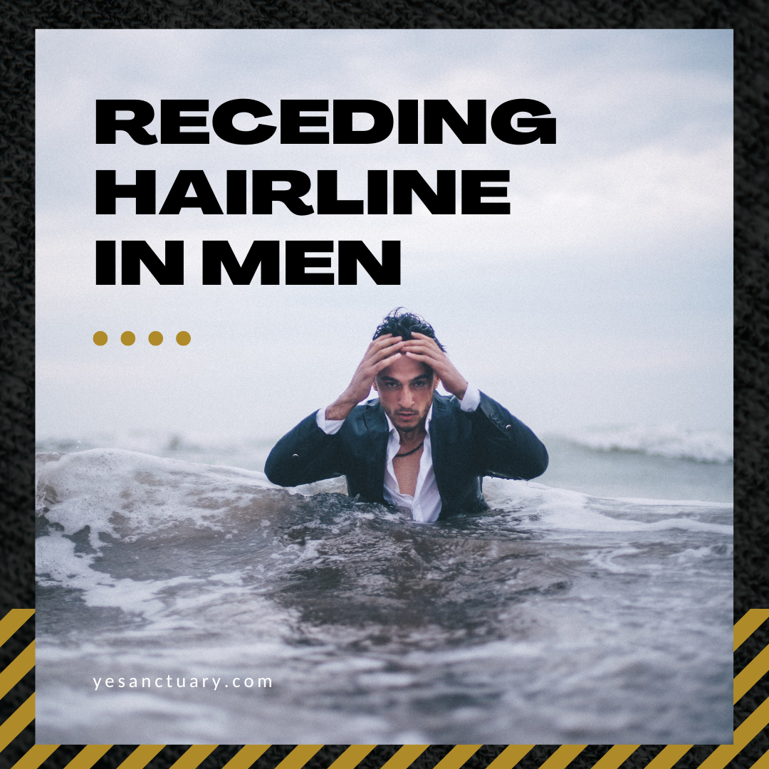 Receding Hairline in Men